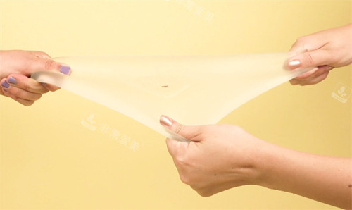 隆胸假体的延展性 隆胸假体的延展性