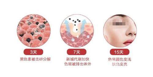 点阵激光的恢复过程