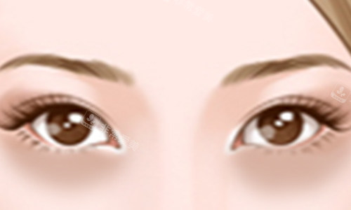 黑眼圈位置展示