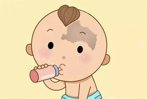 太田痣卡通图 太田痣卡通图