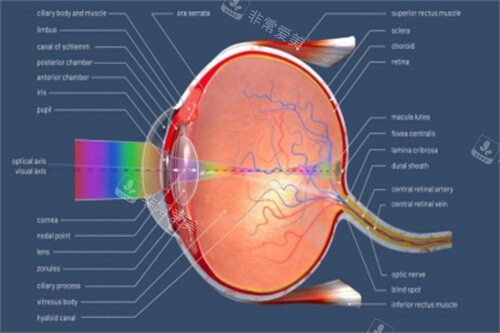 近视（屈光不正）