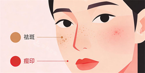 卡通痘印祛斑照片