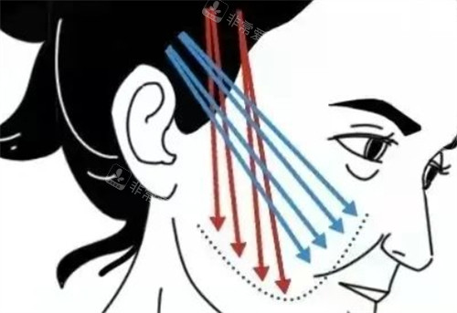 韩国瑳旼皮肤科口碑？...