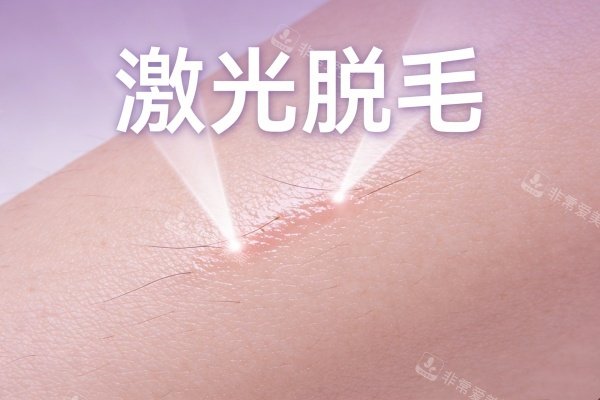 激光脱毛卡通展示图