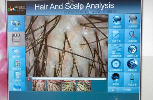 毛囊检测细节图