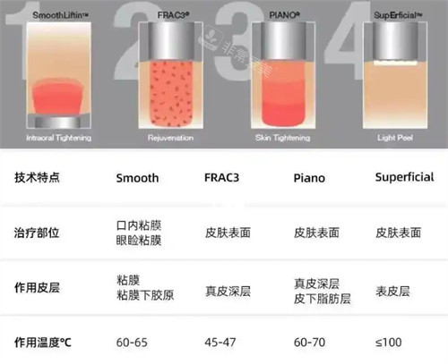 fotona4d欧洲之星技术介绍