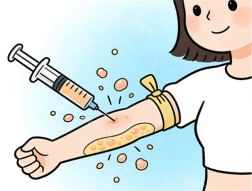 手臂吸脂过程图