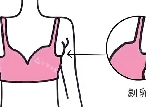 副乳展示动画图 副乳展示动画图