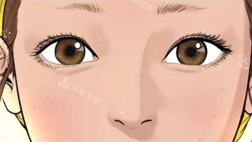 自然双眼皮 自然双眼皮