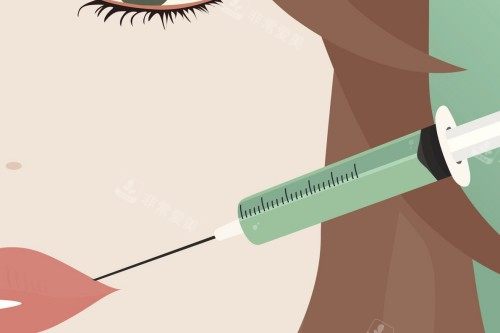 唇部注射宣传图