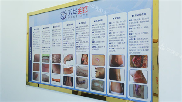 哈尔滨双举专科门诊怎...