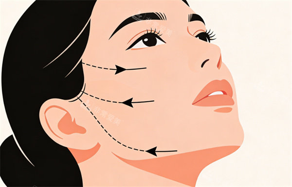 紧致提升卡通图片展示