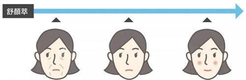 舒颜萃童颜针前后变化