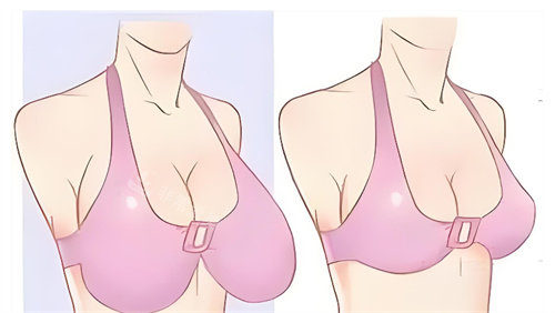 巨乳縮小對比卡通圖