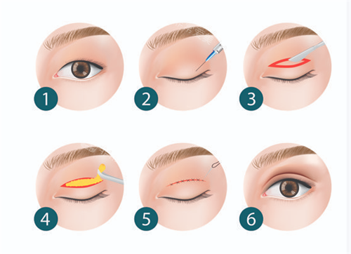 西安美合医疗美容好不...