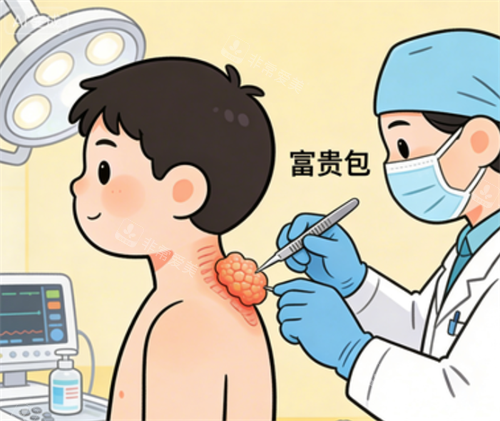 富贵包手术卡通图