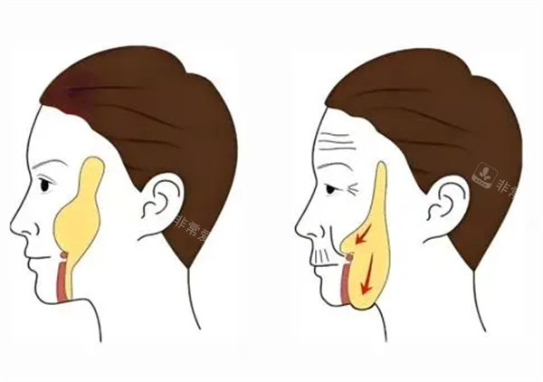 面部轮廓整形卡通图片