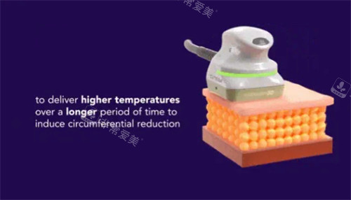 美国既塑3D溶脂操作过程图解