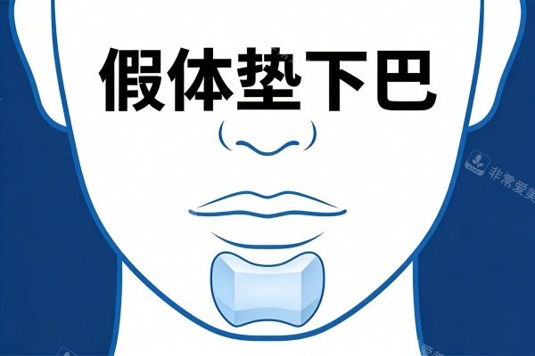 假体垫下巴卡通图一览