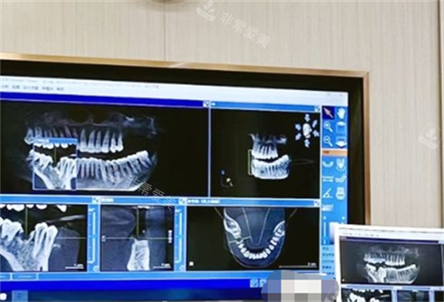 常州北极星口腔诊室拍片检查