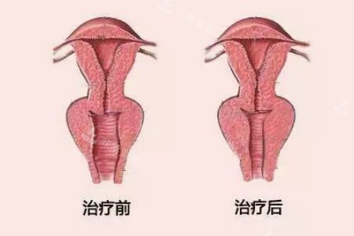 成都私密整形医院有哪些?美茵、亨特、棕南、九龙特色项目一网打尽！