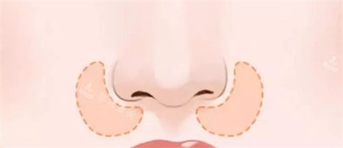 鼻基底鼻部展示图