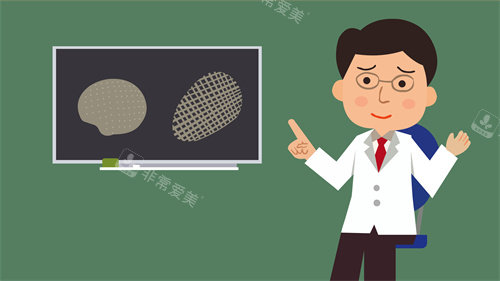 颅骨修复材料的对比动画图