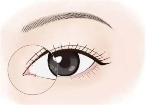 上海佀同帅整形医生双...