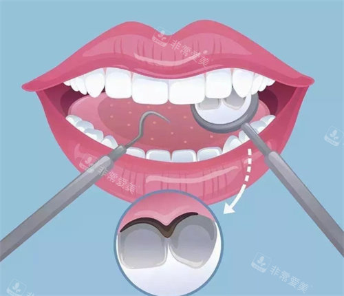 牙齿检查卡通展示