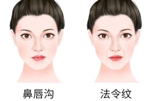 鼻唇沟和法令纹卡通对比图