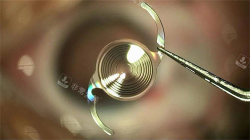 跃无极人工晶体