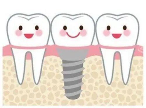 种牙的示意图