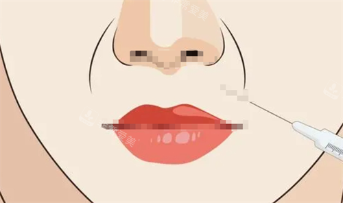 法令纹注射动画展示