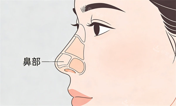 鼻部整形部位卡通图