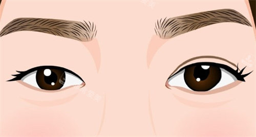 上海王衡健双眼皮价格...