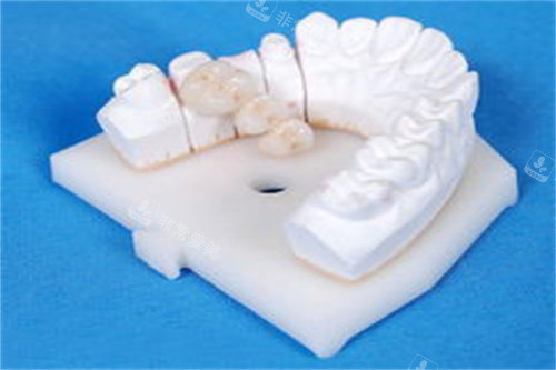 牙齿模型图片展示