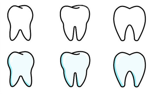 牙齿不同状态
