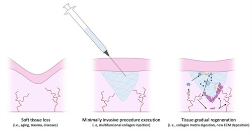 沈阳袁继龙做奥美定取...
