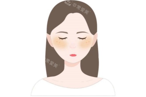 皮肤暗沉卡通图