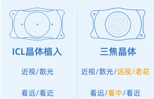 ICL和三焦晶体示意图