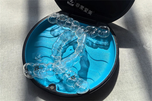 隐适美牙齿矫正