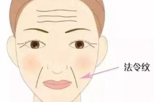 法令纹卡通图 法令纹卡通图