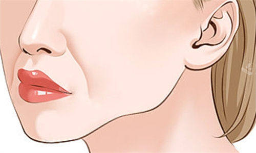 面部衰老法令纹展示图.jpg 面部衰老法令纹展示图.jpg