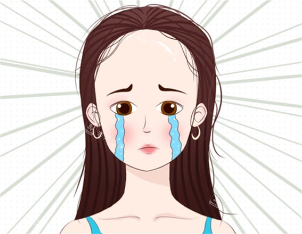 发际线植发卡通图