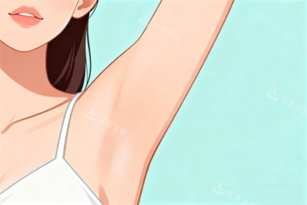 腋下做激光脱毛卡通展示图