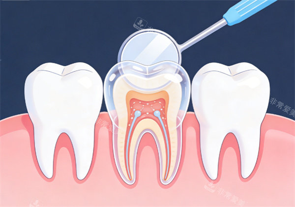 牙齿检查动画示意图