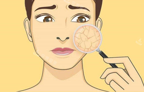 皮肤干燥卡通示意图 皮肤干燥卡通示意图