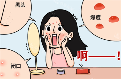 闭口问题 闭口问题