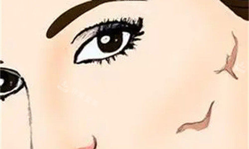 面部疤痕展示图 面部疤痕展示图