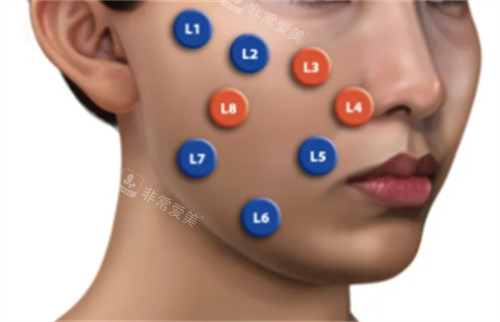 乔雅登不同点位注射方法 乔雅登不同点位注射方法